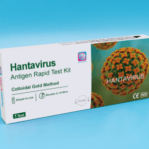 Hantavirus Antigen Rapid Test Kit