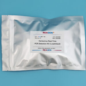 Hantavirus Real-Time PCR Detection Kit (Lyophilized)