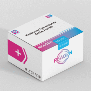 Hantavirus IgG Antibody ELISA Test Kit